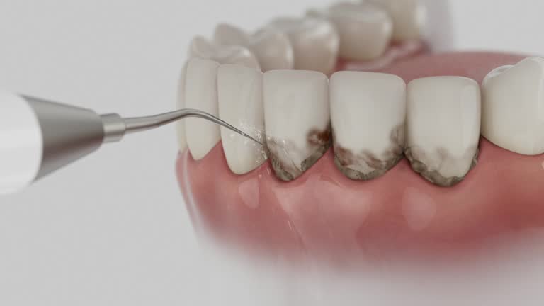 Reliable Tooth Extraction contractor in Lipscomb County County, TX by Dentist Open Now
